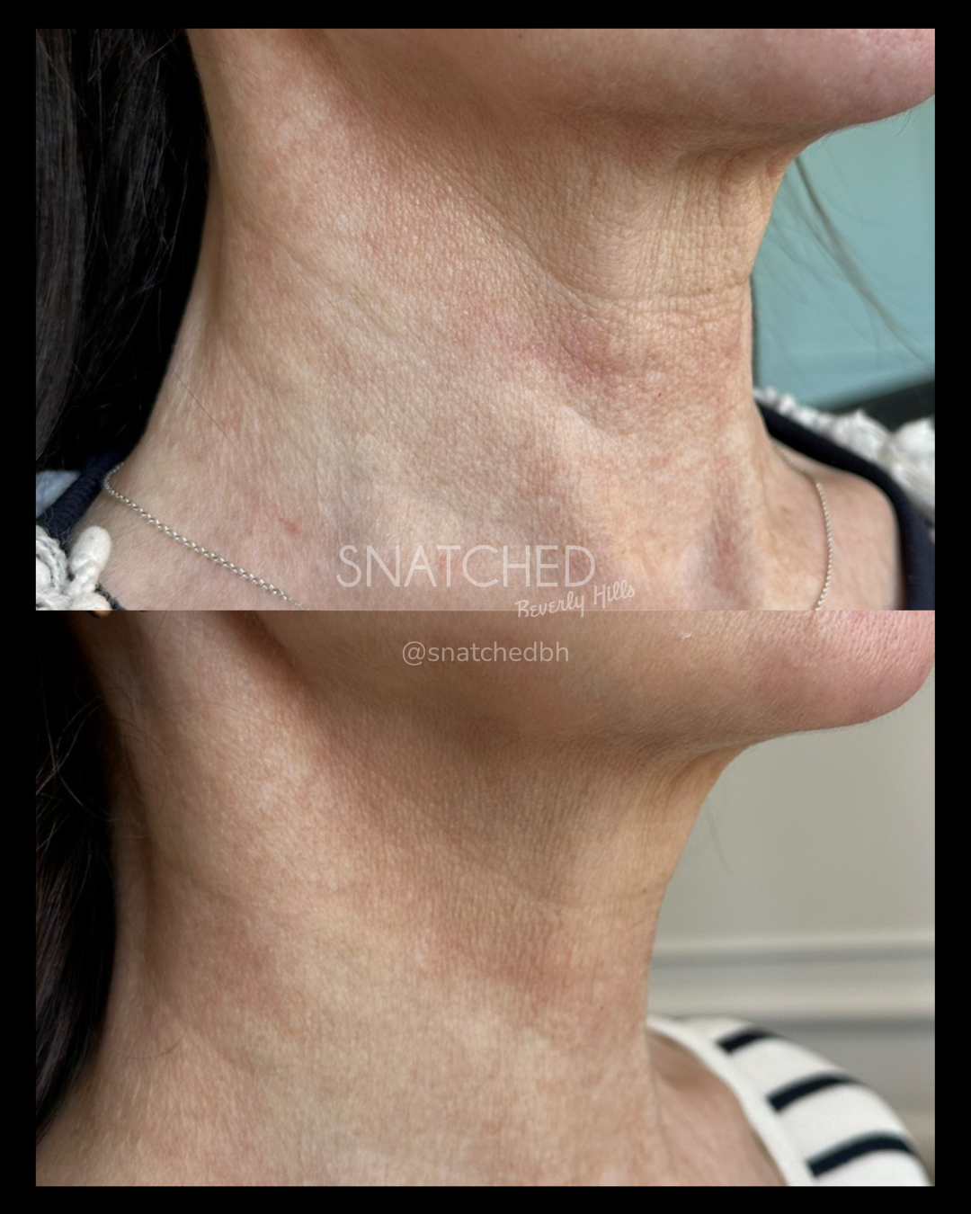 Before and after result 8